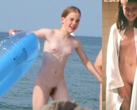 Bare Lake Days photos - Naturism teaches us to accept ourselves and others without judgment